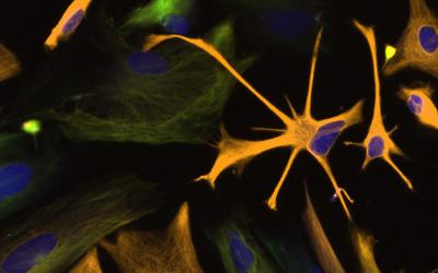 Directed Differentiation Of Multipotential Human Neural Progenitor Cells To Astrocytes