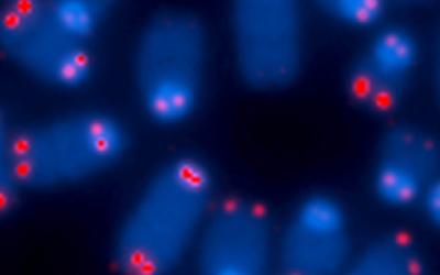 telomeres (red) protect the ends of chromosomes (blue)